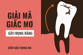 Giải mã giấc mơ bị rụng răng. Đây là điềm báo lành hay dữ?